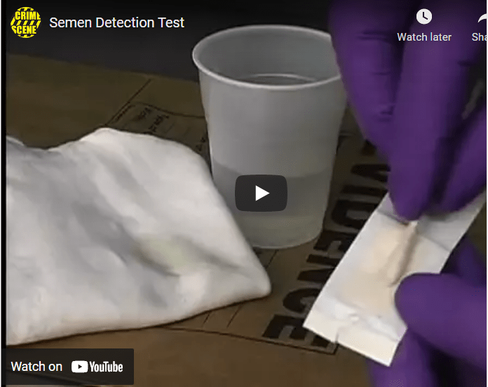 Detection of Semen Stains