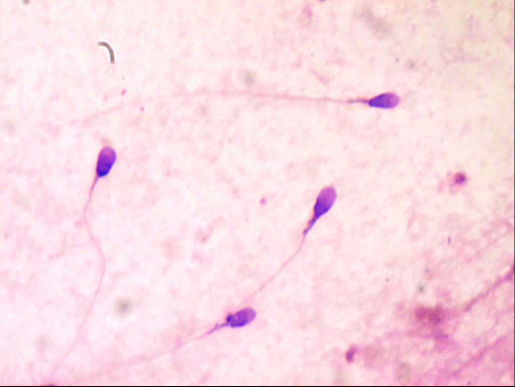 Identification of Semen on the Spot Part 2